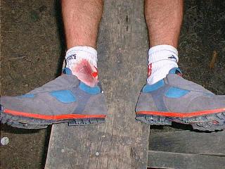 The gory details